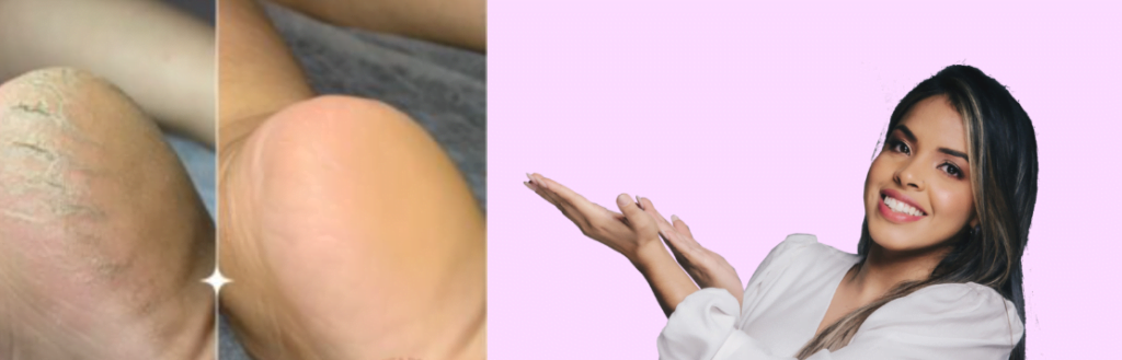 image-1024x329 Apostila Plástica dos pés PDF